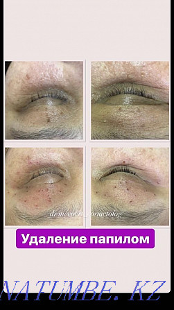 Experienced Cosmetologist Almaty - photo 3