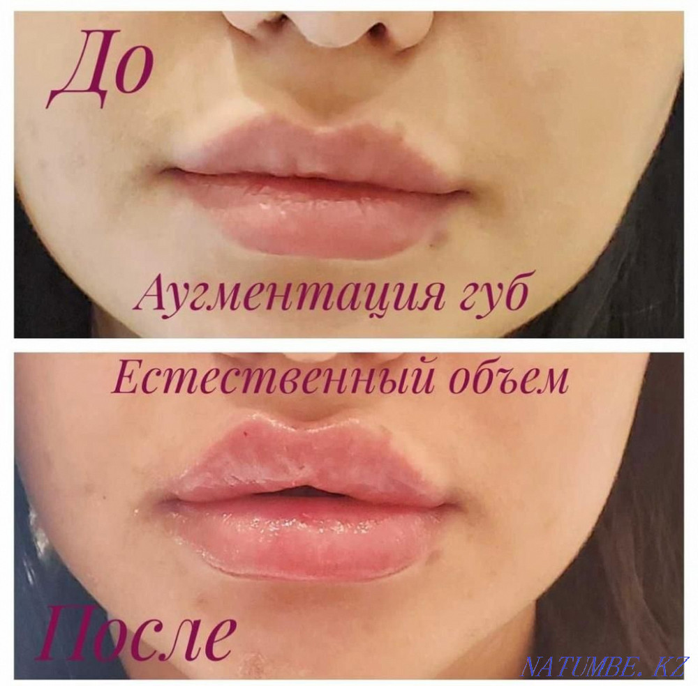 Тәжірибелі косметолог  Алматы - изображение 6