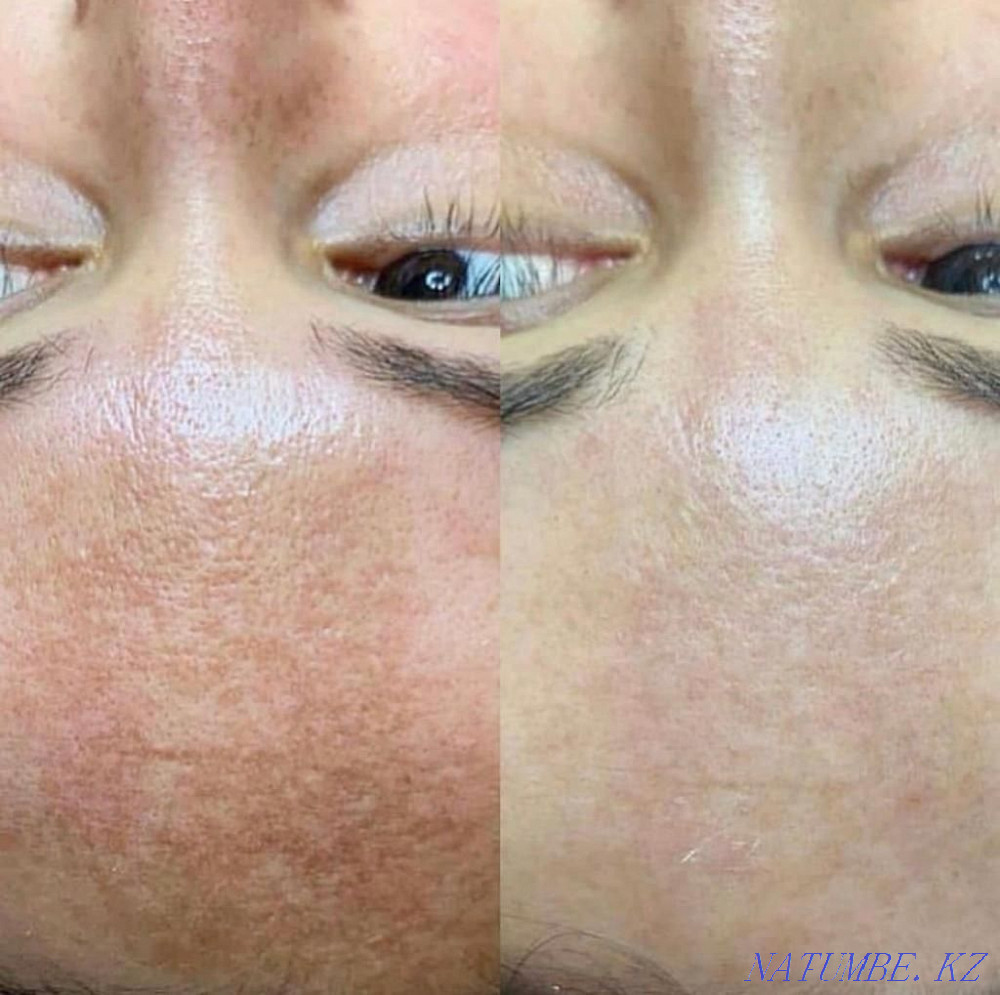 Тәжірибелі косметолог  Алматы - изображение 1