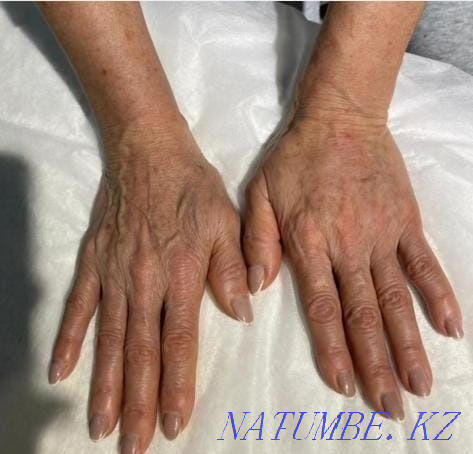 Тәжірибелі косметолог  Алматы - изображение 5