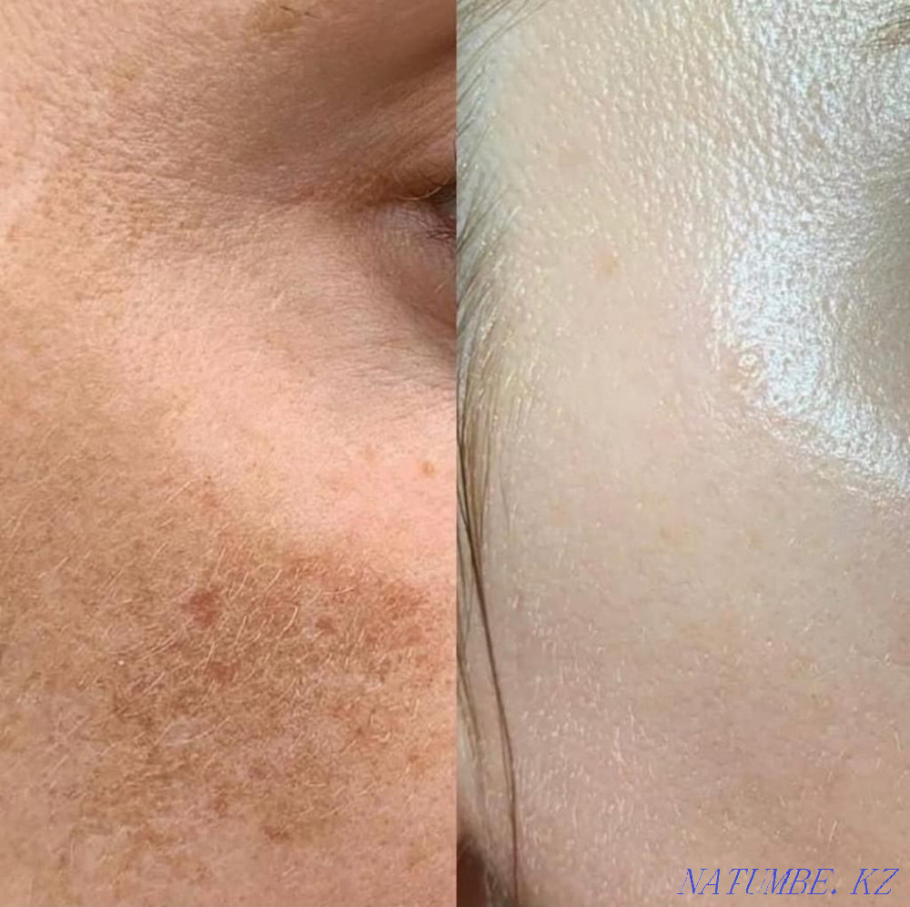 Тәжірибелі косметолог  Алматы - изображение 2