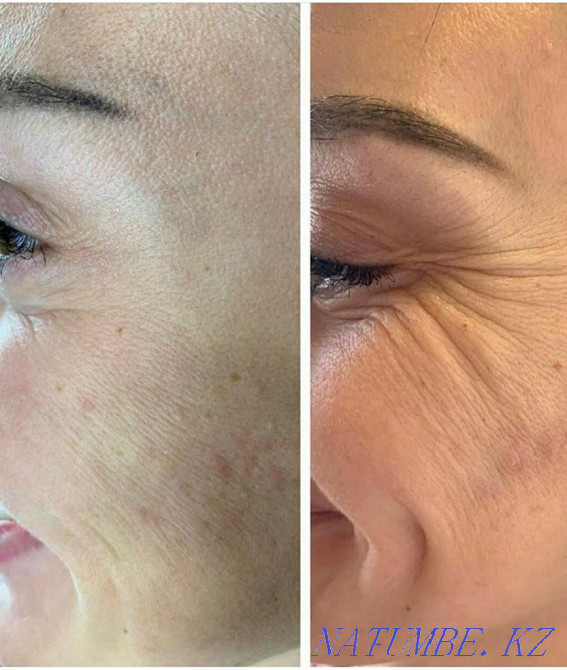 Тәжірибелі косметолог  Алматы - изображение 8