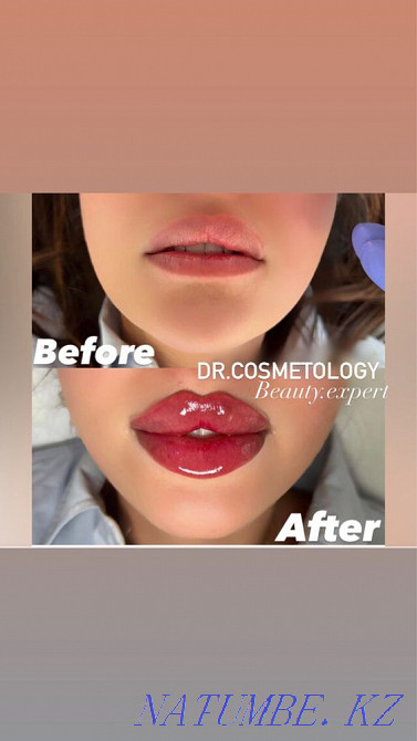 Косметолог Астана - изображение 4