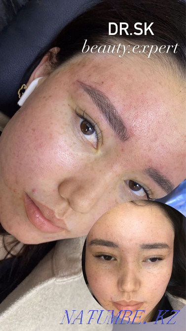 Косметолог Астана - изображение 3