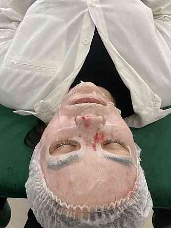 Косметологическая Капиляротерапия для лица ( Хиджама) Актобе