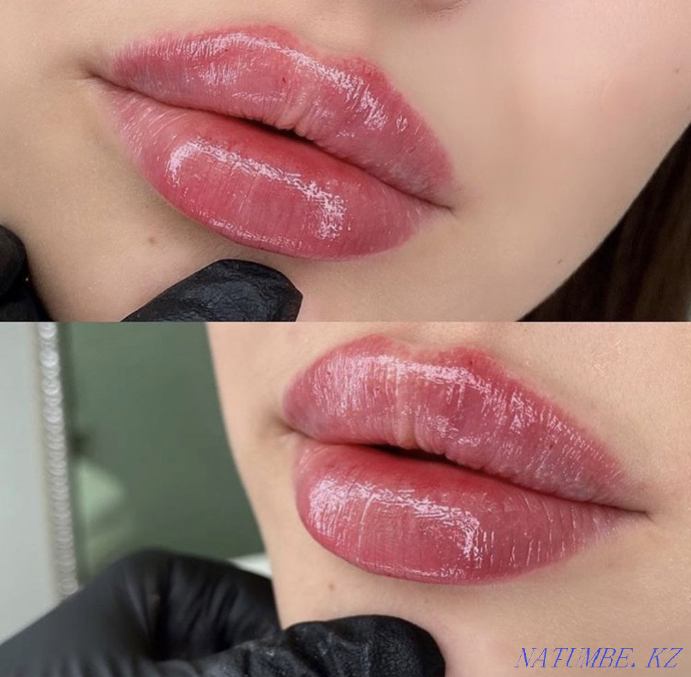 need models for lip augmentation 0.5ml-12000.1 ml -20000 tg Shymkent - photo 5