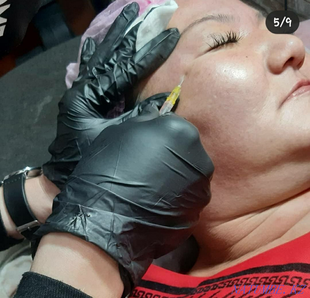 Обучение курсы Косметолог мезотерапевт инъекционно Каскелен - изображение 5