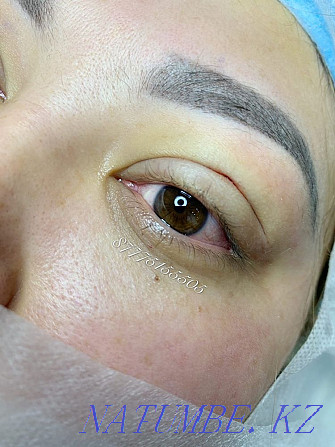 Eyelid blepharoplasty with Sangapuri threads Atyrau - photo 2