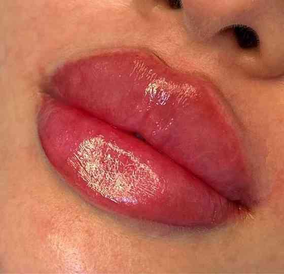 Увеличение губ Atyrau