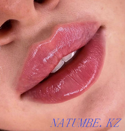 Lip augmentation Atyrau - photo 1