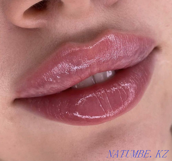 Lip augmentation Atyrau - photo 2