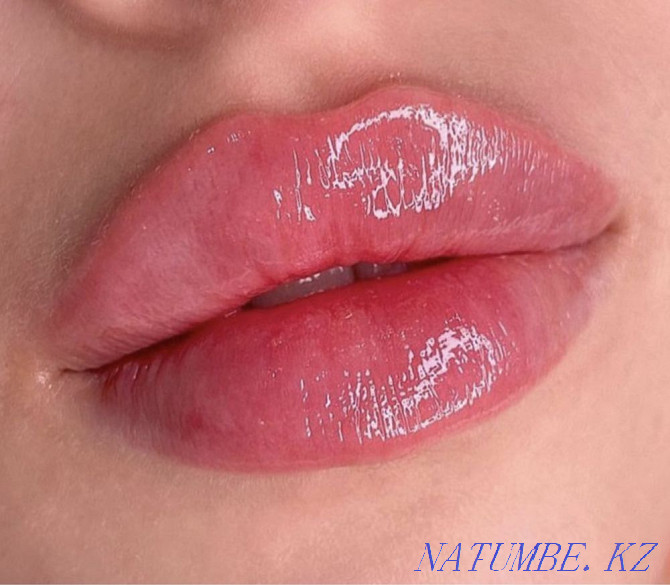 Lip augmentation Atyrau - photo 3