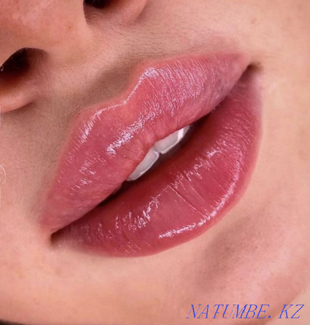 Увеличение губ Атырау - изображение 1