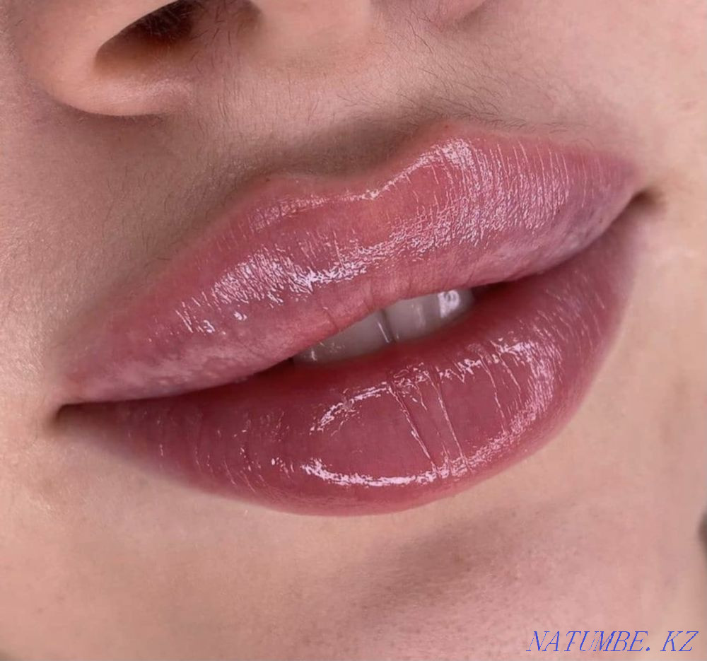 Увеличение губ Атырау - изображение 2