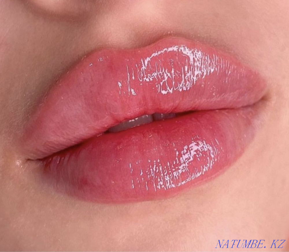 Увеличение губ Атырау - изображение 3