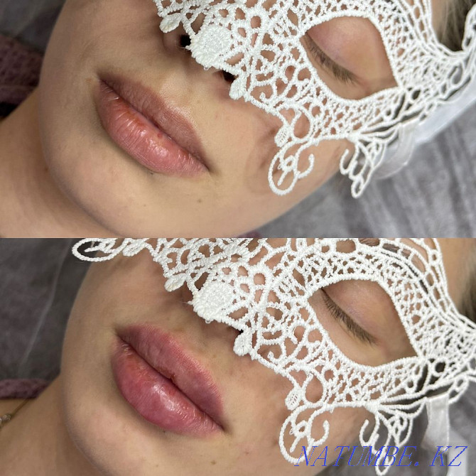 Lip augmentation for 25000 tenge Karagandy - photo 3