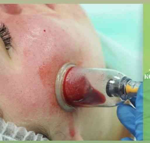 Массаж и чистка лица Oral