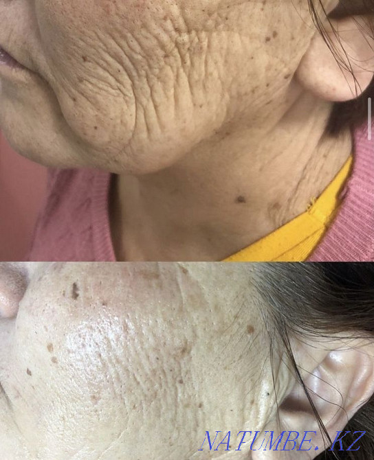 Facial massage and cleansing Oral - photo 1