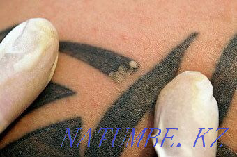 Tattoo removal from 3000tg. Experience 10 years. Almaty - photo 2