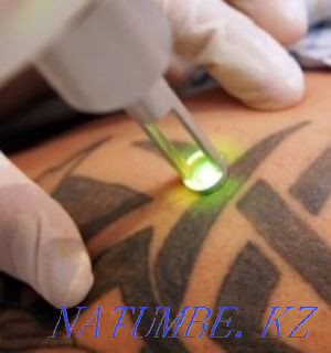 Tattoo removal from 3000tg. Experience 10 years. Almaty - photo 1