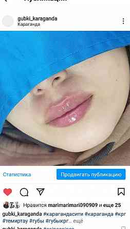 Увеличение губ. Контурная пластика. Karagandy
