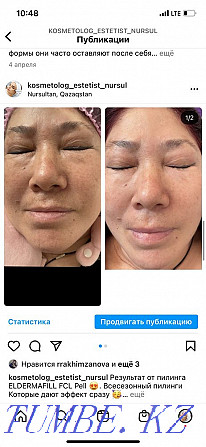 Cosmetologist 24/7 Astana - photo 2