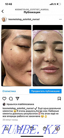 Cosmetologist 24/7 Astana - photo 1