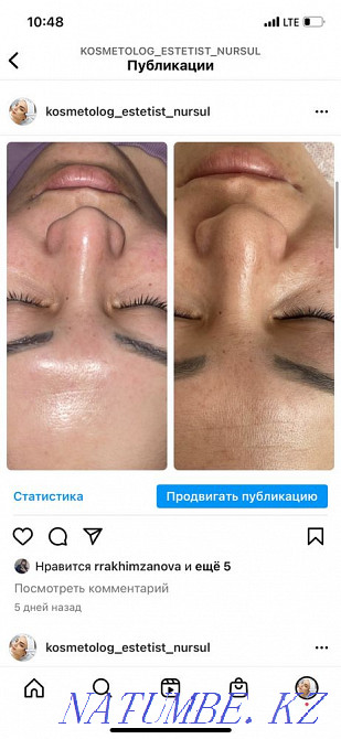 Cosmetologist 24/7 Astana - photo 3