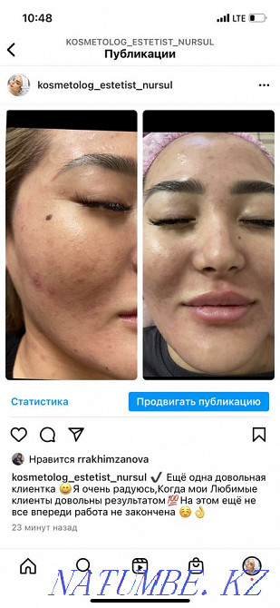 Cosmetologist 24/7 Astana - photo 1