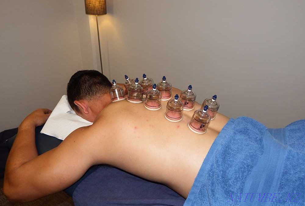 Гирудотерапия(Пиявки).Апитерапия Туркестан - изображение 4