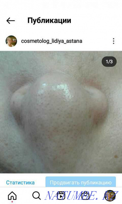 Бет тазарту 3000-6000  Астана - изображение 5