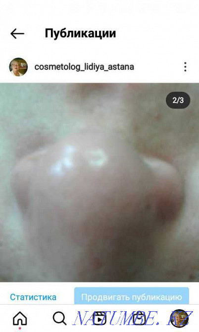 Бет тазарту 3000-6000  Астана - изображение 6