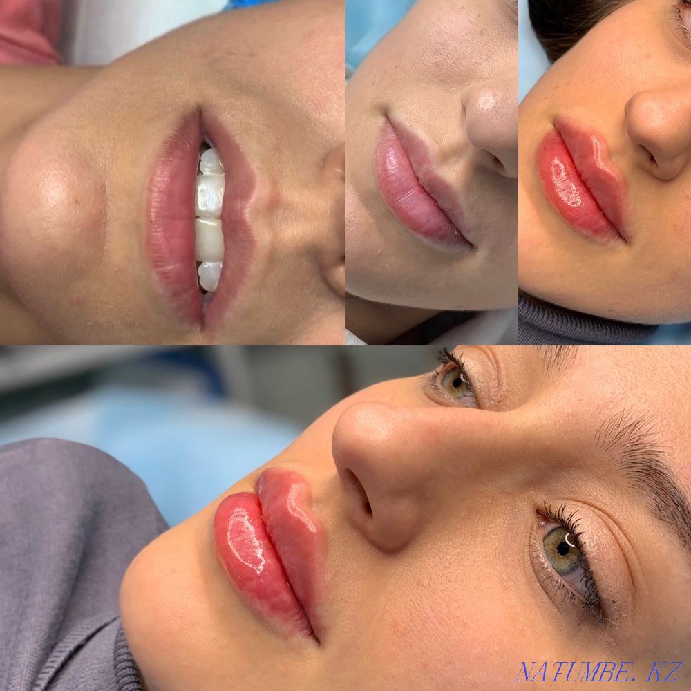 A set of models in Almaty on 18.04.22 Almaty - photo 3