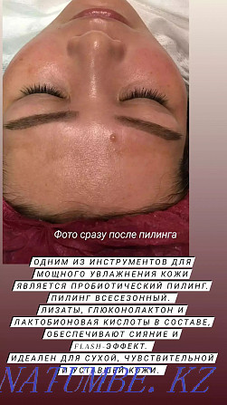 Facial cleansing, care procedures Astana - photo 4