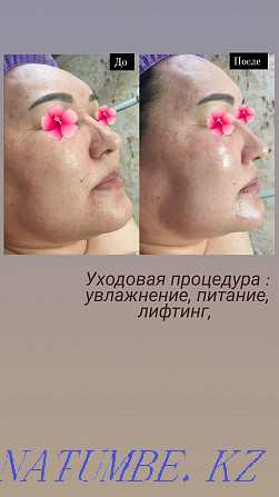 Facial cleansing, care procedures Astana - photo 1
