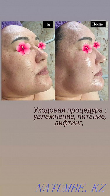 Facial cleansing, care procedures Astana - photo 1