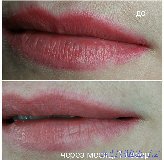 Lip Blushing Tattoo Treatment Darkens Lip Color Before and After Photos   Allure