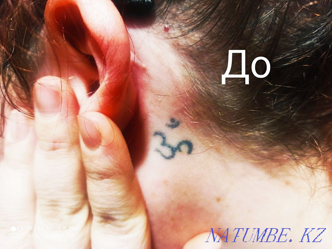 Татуировканы кетіру / тұрақты макияж  Алматы - изображение 3