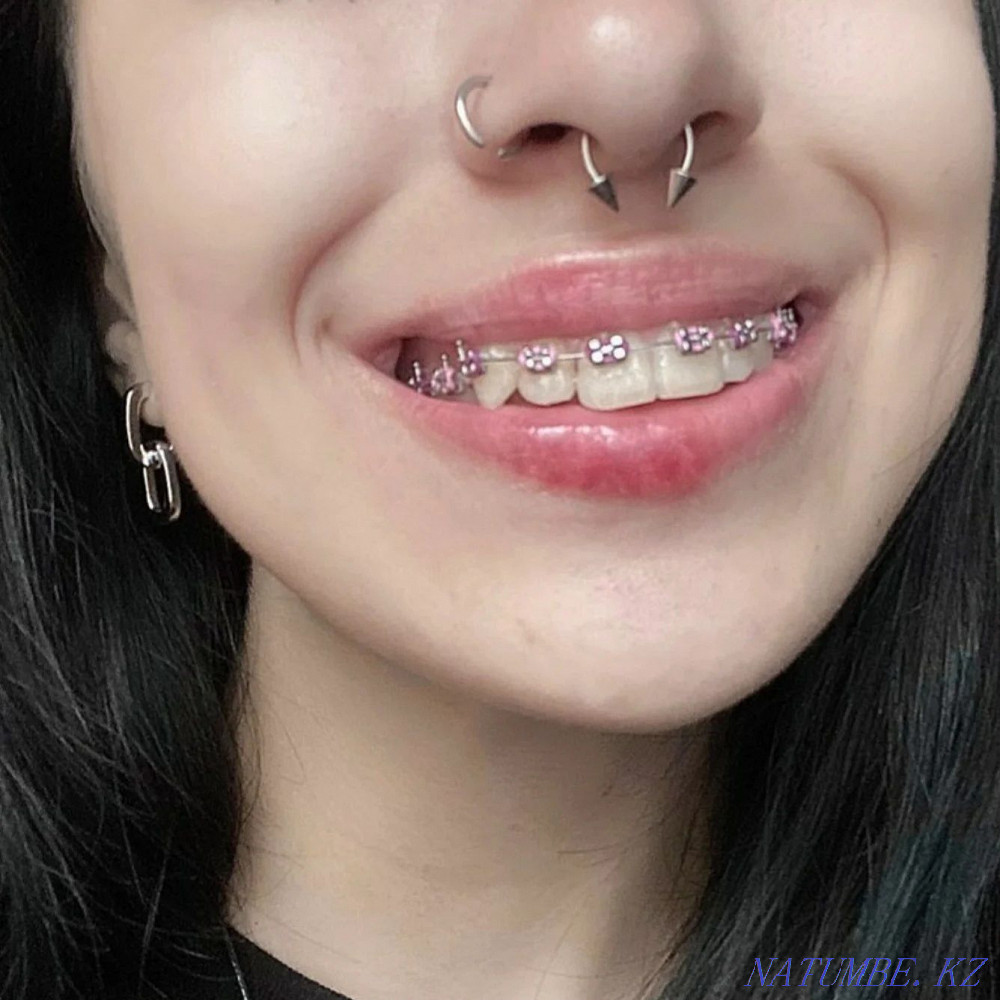 Piercings and punctures Oral - photo 7