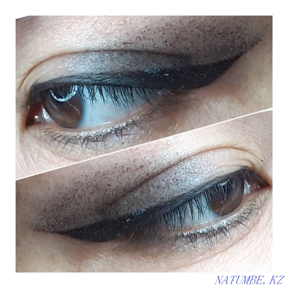 Laser tattoo removal Shymkent - photo 5