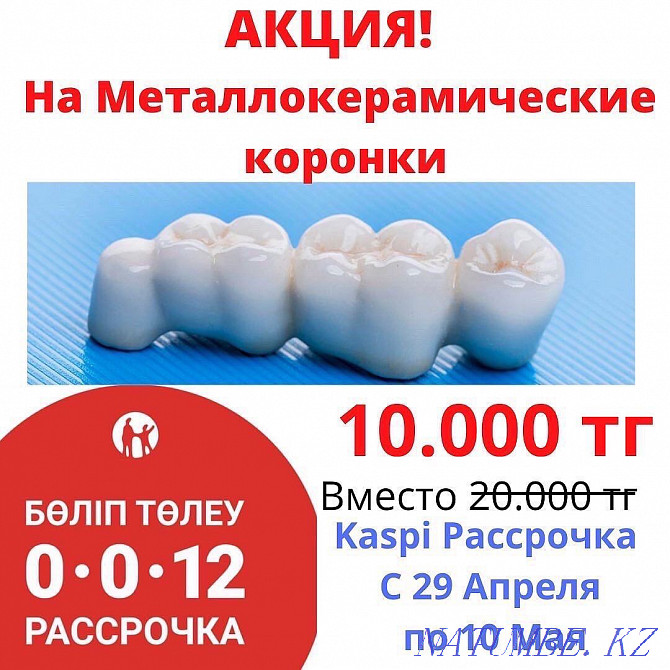 Metal ceramics Dentistry Almaty Implants Braces Dentures Veneers Almaty - photo 1