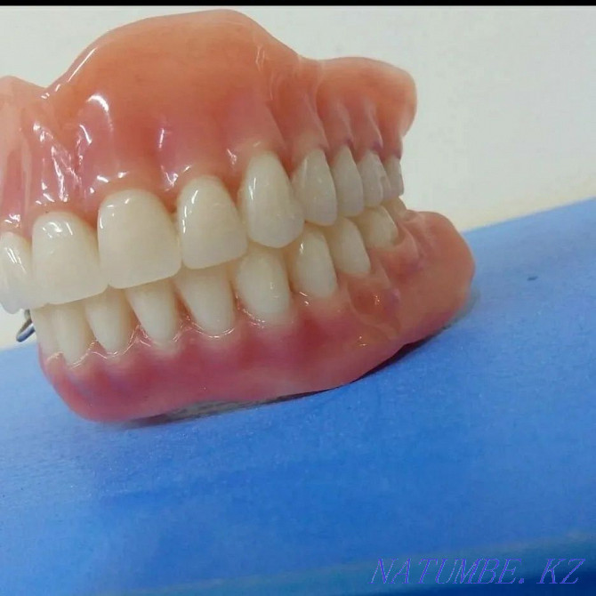 Изготовление и ремонт зубных протезов Алматы - изображение 7