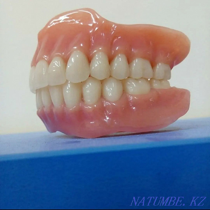 Изготовление и ремонт зубных протезов Алматы - изображение 4