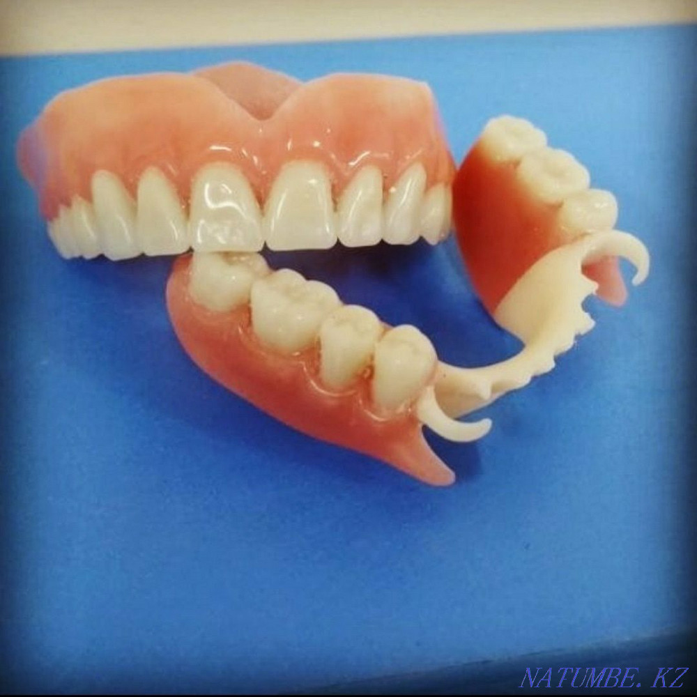 Изготовление и ремонт зубных протезов Алматы - изображение 3