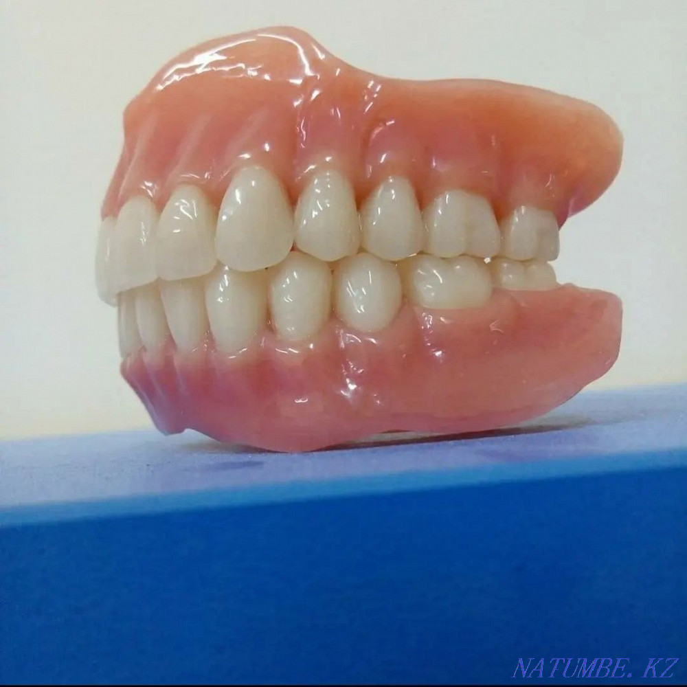 Изготовление и ремонт зубных протезов Алматы - изображение 4