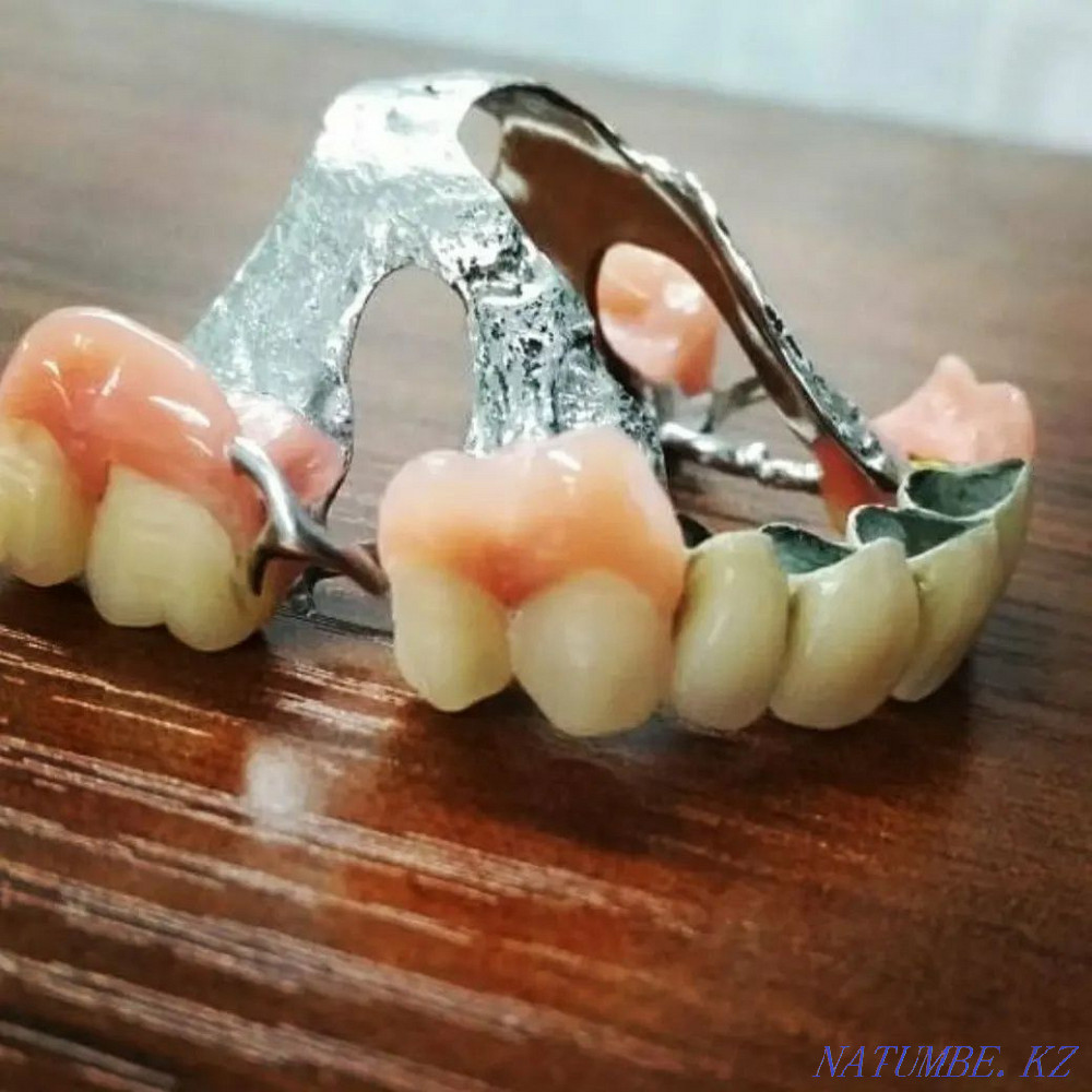 Изготовление и ремонт зубных протезов Алматы - изображение 6