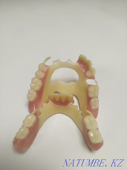 ??????All types of dental services by UAPF pension transfer Almaty - photo 4