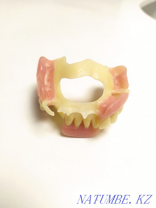 ??????All types of dental services by UAPF pension transfer Almaty - photo 7