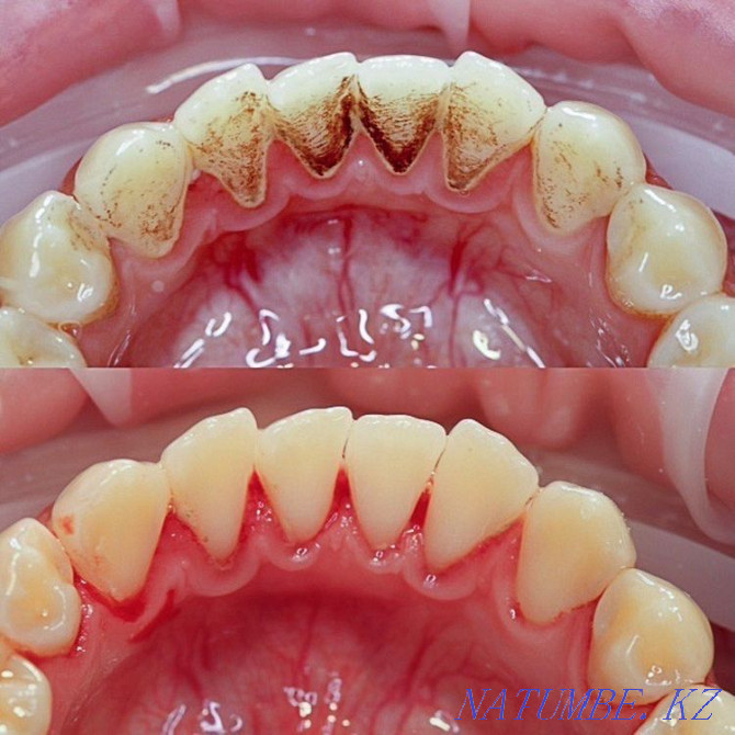 Saruar Dental Clinic Taraz - photo 3