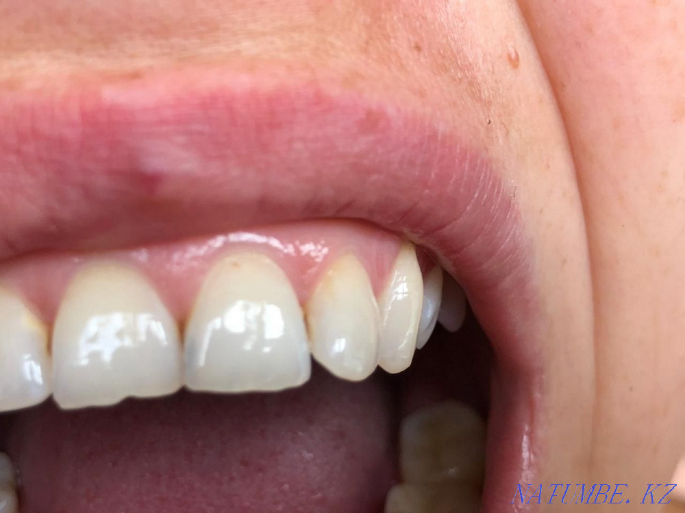 All types of dentistry Almaty - photo 4